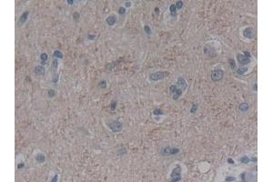 Detection of FGF12 in Human Cerebrum Tissue using Polyclonal Antibody to Fibroblast Growth Factor 12 (FGF12)