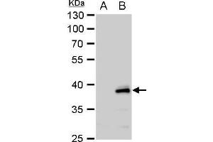 WB Image YKL-39 antibody [N1C3] detects YKL-39 protein by western blot analysis. (CHI3L2 anticorps)