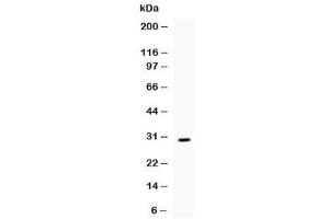 Western blot testing of recombinant mouse IL17 protein (0. (IL-17 anticorps  (AA 26-158))