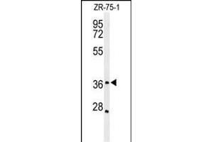 Western blot analysis of MIIP Antibody (C-term) (ABIN651250 and ABIN2840153) in ZR-75-1 cell line lysates (35 μg/lane). (MIIP anticorps  (C-Term))