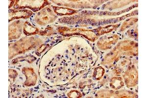 Immunohistochemistry of paraffin-embedded human kidney tissue using ABIN7173996 at dilution of 1:100 (YARS anticorps  (AA 2-528))