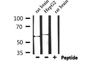 Western blot analysis of extracts from rat brain and HepG2, using TRIO Antibody.