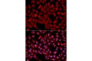 Immunofluorescence (IF) image for anti-E3 Ubiquitin-Protein Ligase SIAH1 (SIAH1) antibody (ABIN1874778) (SIAH1 anticorps)
