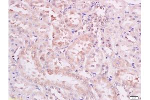 Paraformaldehyde-fixed, paraffin embedded rat kidney tissue, Antigen retrieval by boiling in sodium citrate buffer (pH6) for 15min, Block endogenous peroxidase by 3% hydrogen peroxide for 30 minutes, Blocking buffer (normal goat serum) at 37°C for 20min, Antibody incubation with Rabbit Anti-PDK1(Ser241) Polyclonal Antibody, Unconjugated  at 1:200 overnight at 4°C, followed by a conjugated secondary antibody and DAB staining.