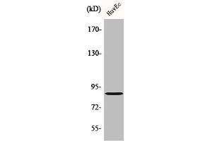 Western Blot analysis of HuvEc cells using cGKII Polyclonal Antibody