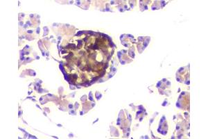 IHC analysis of ATP citrate lyase using anti-ATP citrate lyase antibody (ABIN6719406).
