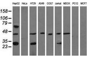 Western blot analysis of extracts (35 µg) from 9 different cell lines by using anti-QPRT monoclonal antibody. (QPRT anticorps)