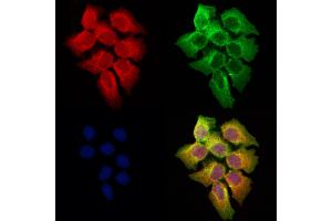 ABIN6258102 and ABIN6273682 staining Hela cells by IF/ICC. (Keratin 36 anticorps  (Internal Region))