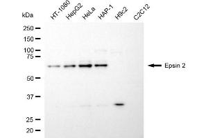 Western blotting analysis using epsin 2 antibody (ABIN7798489). (Epsin 2 anticorps)
