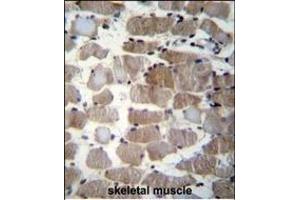 CTSK Antibody (Center ) (ABIN656812 and ABIN2846026) immunohistochemistry analysis in formalin fixed and paraffin embedded human skeletal muscle followed by peroxidase conjugation of the secondary antibody and DAB staining. (Cathepsin K anticorps  (AA 97-126))