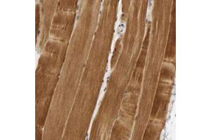 Immunohistochemical staining (Formalin-fixed paraffin-embedded sections) of human skeletal muscle with PDLIM3 polyclonal antibody  shows strong cytoplasmic positivity in myocytes. (PDLIM3 anticorps)