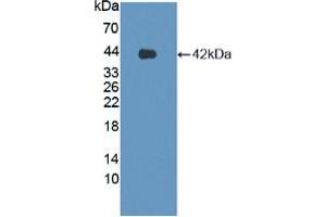 Western blot analysis of recombinant Human LPHN3. (LPHN3 anticorps  (AA 1105-1447))