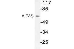 Western blot analysis using eIF3D antibody in extracts from 3T3 cells.