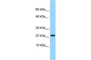 WB Suggested Anti-NDUFAF2 Antibody Titration: 1.