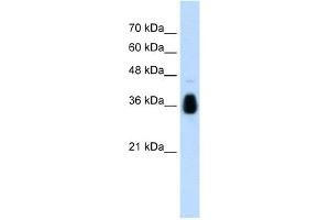 WB Suggested Anti-MKRN1 Antibody Titration:  1. (MKRN1 anticorps  (C-Term))