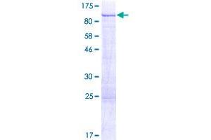 Image no. 1 for Protein Kinase C, delta (PKCd) (AA 1-676) protein (GST tag) (ABIN1316258)