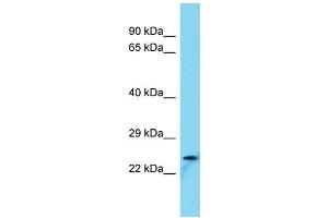 Host: Rabbit Target Name: FAM101B Sample Type: U937 Whole Cell lysates Antibody Dilution: 1. (FAM101B anticorps  (N-Term))