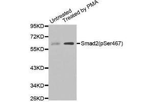 Western blot analysis of extracts of Untreated and treated 293T cell lines, using Phospho-SMAD2-S467 antibody.