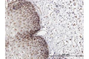 Immunoperoxidase of purified MaxPab antibody to LHX4 on formalin-fixed paraffin-embedded human esophagus.