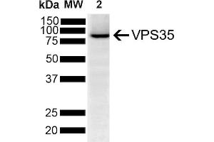 Western Blot analysis of Human SH-SY5Y showing detection of VPS35 protein using Mouse Anti-VPS35 Monoclonal Antibody, Clone 5A9 (ABIN6932942). (VPS35 anticorps  (APC))