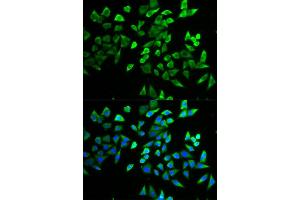Immunofluorescence (IF) image for anti-Transcription Factor 19 (TCF19) antibody (ABIN1877133) (TCF19 anticorps)