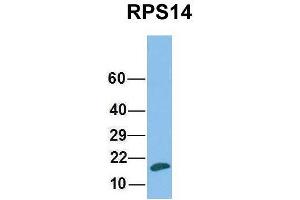 Host:  Rabbit  Target Name:  RPS14  Sample Type:  Human Fetal Liver  Antibody Dilution:  1.