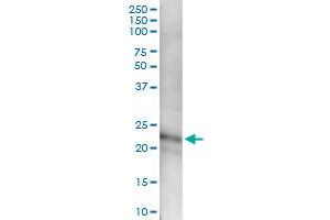 Immunoprecipitation of CFC1 transfected lysate using anti-CFC1 MaxPab rabbit polyclonal antibody and Protein A Magnetic Bead , and immunoblotted with CFC1 MaxPab mouse polyclonal antibody (B01) . (CFC1 anticorps  (AA 1-223))