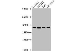 Western Blot Positive WB detected in: Jurkat whole cell lysate, HEK293 whole cell lysate, U87 whole cell lysate, SH-SY5Y whole cell lysate All lanes: CAMLG antibody at 3 μg/mL Secondary Goat polyclonal to rabbit IgG at 1/50000 dilution Predicted band size: 33 kDa Observed band size: 33 kDa (CAMLG anticorps  (AA 1-189))