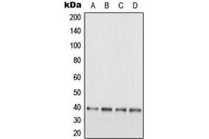 Western blot analysis of EB3 expression in SHSY5Y (A), HeLa (B), SP2/0 (C), PC12 (D) whole cell lysates. (MAPRE3 anticorps  (C-Term))