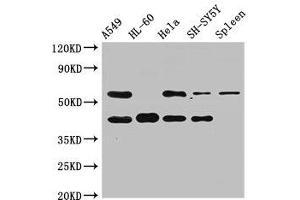 Western Blot Positive WB detected in: A549 whole cell lysate, HL60 whole cell lysate, Hela whole cell lysate, SH-SY5Y whole cell lysate, Rat spleen tissue All lanes: BACE2 antibody at 2. (BACE2 anticorps  (AA 84-157))
