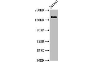 Western Blot Positive WB detected in: Jurkat whole cell lysate All lanes: CARMIL2 antibody at 1:1000 Secondary Goat polyclonal to rabbit IgG at 1/50000 dilution Predicted band size: 155, 149 kDa Observed band size: 155 kDa (RLTPR anticorps  (AA 1136-1290))