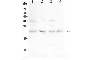 Western blot analysis of TIMP1 using anti-TIMP1 antibody . (TIMP1 anticorps  (AA 24-207))