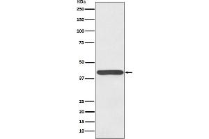 Western blot analysis of Haptoglobin expression in human plasma lysate.