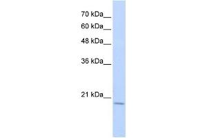 WB Suggested Anti-RBM39 Antibody Titration:  0. (RBM39 anticorps  (Middle Region))