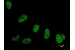 Immunofluorescence of purified MaxPab antibody to SYMPK on HeLa cell. (Symplekin anticorps  (AA 1-533))