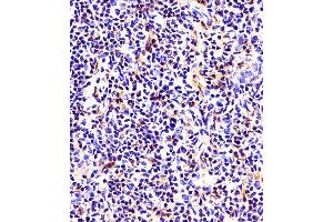(ABIN6242660 and ABIN6578661) staining beta Tubulin in mouse thymus tissue sections by Immunohistochemistry (IHC-P - paraformaldehyde-fixed, paraffin-embedded sections).