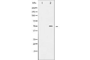 Western blot analysis of AML1 phosphorylation expression in Jurkat whole cell lysates,The lane on the left is treated with the antigen-specific peptide.