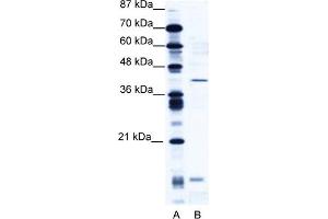 WB Suggested Anti-CREM Antibody Titration:  2.