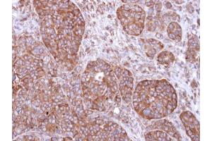 IHC-P Image Immunohistochemical analysis of paraffin-embedded SW480 xenograft, using FBXL2, antibody at 1:500 dilution. (FBXL2 anticorps  (N-Term))
