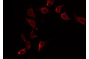 ABIN6269303 staining HuvEc by IF/ICC.