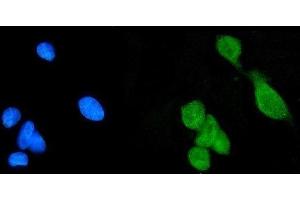 IF analysis of Daxx using anti-Daxx antibody (ABIN3043822).
