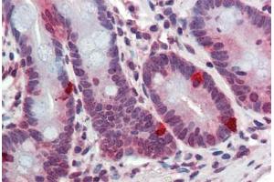Human Small Intestine: Formalin-Fixed, Paraffin-Embedded (FFPE) (ARL2 anticorps  (AA 123-184))