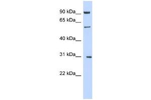 WB Suggested Anti-MGAT2 Antibody Titration:  0. (MGAT2 anticorps  (Middle Region))