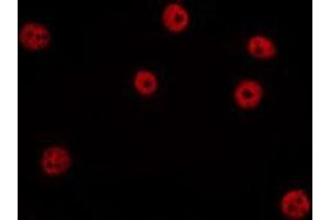 ABIN6275736 staining HepG2 by IF/ICC.