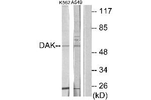 Western blot analysis of extracts from K562 cells and A549 cells, using DAK antibody. (DAK anticorps  (Internal Region))