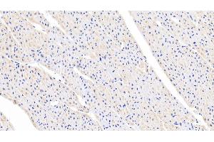 Detection of FGF1 in Porcine Cardiac Muscle Tissue using Polyclonal Antibody to Fibroblast Growth Factor 1, Acidic (FGF1)