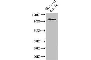Western Blot Positive WB detected in: Mouse skeletal muscle tissue All lanes: SLFN11 antibody at 2. (SLFN11 anticorps  (AA 670-821))