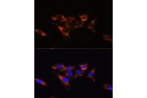Immunofluorescence analysis of C6 cells using A antibody (ABIN3022193, ABIN3022194, ABIN3022195 and ABIN6218659) at dilution of 1:100.