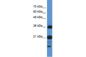 WB Suggested Anti-C1orf144  Antibody Titration: 0. (C1orf144 anticorps  (N-Term))