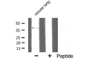 Western blot analysis of SUCNR1 expression in mouse lung. (SUCNR1 anticorps  (Internal Region))